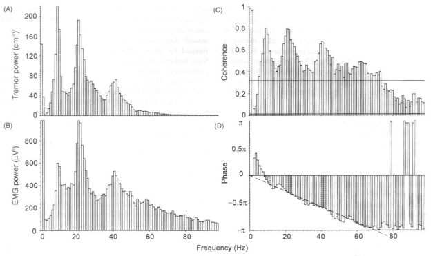Power speectral estimates and coherence analysis of 50% MVC of 1DI against an elastic resustance. Peaks at 10, 22 and 41 Hz in accelerometer tremor record and rectified surface EMG power spectra. Coherence analysis reveals strong coherence especially at these peaks. Upper horizontal line is the 95% confidence interval for significantly greater coherence compared to the whole spectrum – only lower 100 Hz of spectrum shown. Lower horiz line is 95% confidence interval for non-zero coherence. There is a constant linear phase lag of tremor behind EMG at all frequencies, indicating a value of 6.5 ms lag.